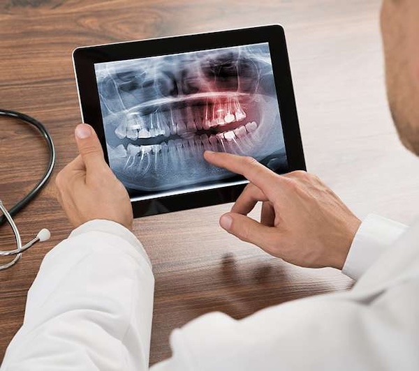 Endodontics in Staten Island, NY