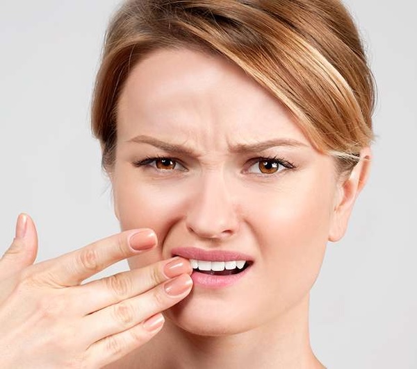 Chipped tooth in Staten Island, NY