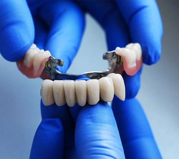 Dental Bridges in Staten Island, NY
