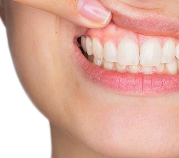 Gum Disease in Staten Island, NY