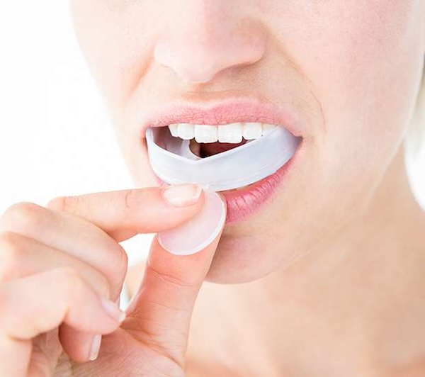 Mouth Guards in Staten Island, NY