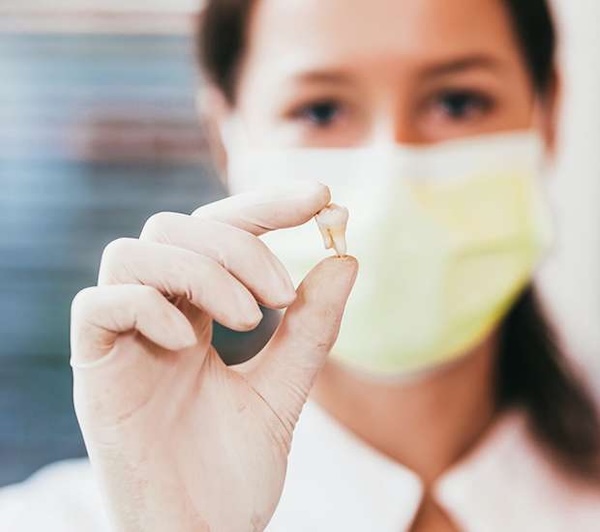 Tooth Extraction in Staten Island, NY