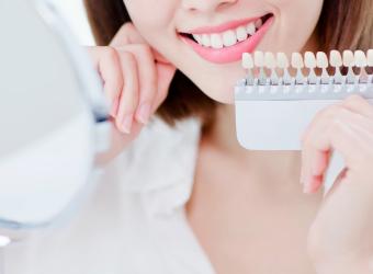 Do Home Teeth Whitening Kits Work? Which Ones Are Best?