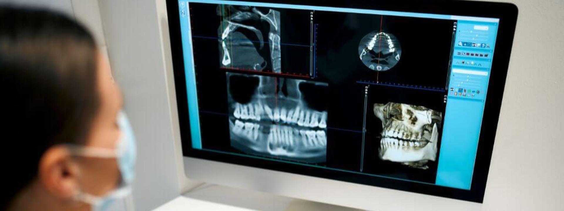 Dental X-Rays: The 4 Different Types and Their Use