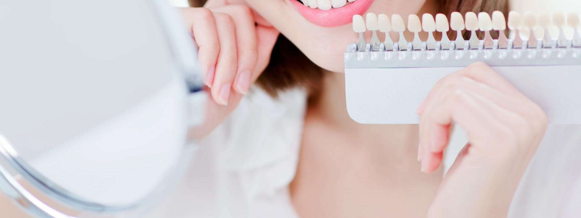 Home Teeth Whitening Kits